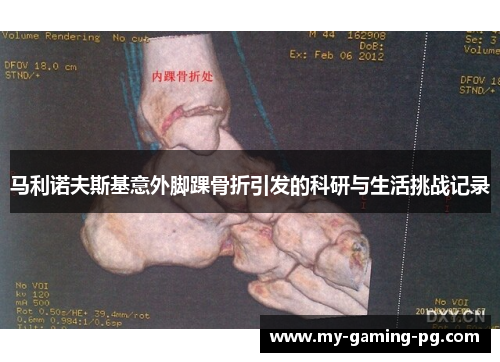 马利诺夫斯基意外脚踝骨折引发的科研与生活挑战记录 马利诺夫斯基意外脚踝骨折引发的科研与生活挑战记录